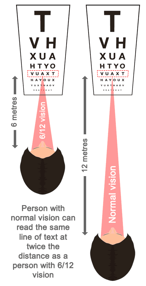 Legal Eyesight Requirements For Driving UK Learn Automatic